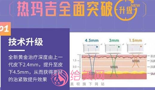 热玛吉五代做一次多少钱？热玛吉是什么原理？手术注意事项分享！