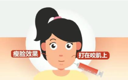 进口多少钱一针？打完之后脸会下垂吗？果能维持多久？