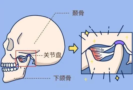 磨下颌骨要多少钱？哪些因素影响磨下颌骨手术费用呢？下颌角费用参考