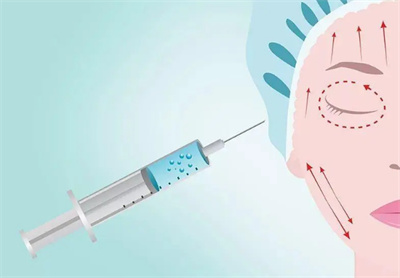 打玻尿酸效果能维持多久？ 注射完后需要注意事项有哪些？