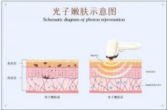 吉林大学第二医院美容科光子嫩肤美白果好吗？专家团队|特色项目！等你来看~