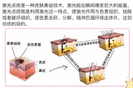 苏大附二院谢晓明怎么样？医生个人简介-切痣真实案例反馈！