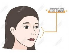 重庆颧骨内推医生排行榜公布！了解他们的风格、审美！五位铸颜~ 