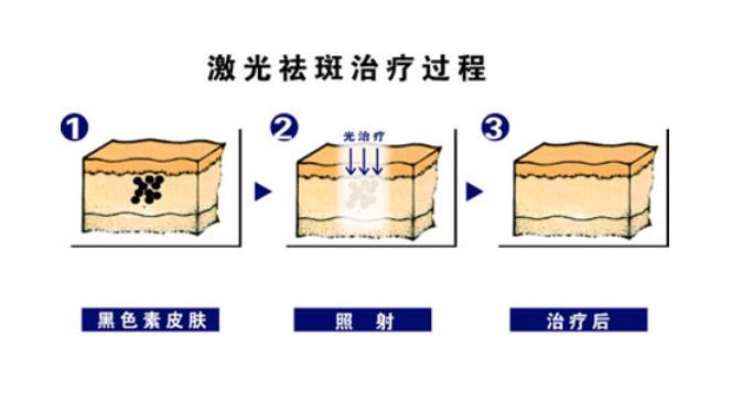 北京八大处激光科哪个医生好？王佳琦、杨明勇实力解读！附祛斑案例