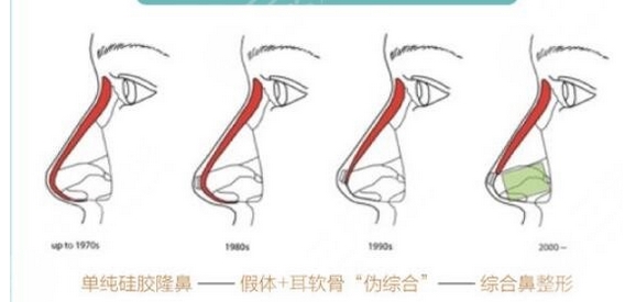 北京八大处辛敏强和刘春军谁技术更好？北京整形医生实力PK！看看测评吧~