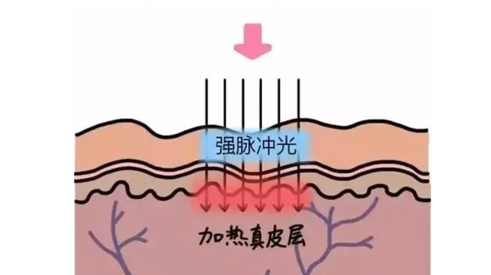 北京八大处光子嫩肤多少钱一次？谁做的好？价格表_张波医生简介