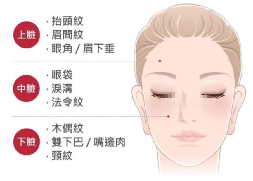 迷你小拉皮前后对比:做之前45岁，做之后年轻了10岁-！