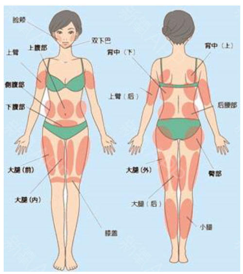 广州联合丽格叶海洲怎么样？医生个人简介_抽脂科普_价格表