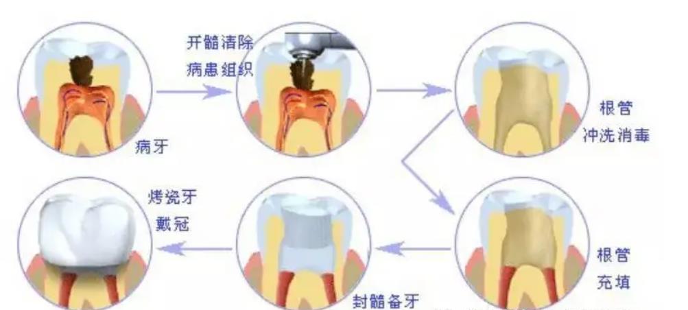 北京卓越口腔第二门诊部怎么样？口碑简介、牙齿修复操作过程