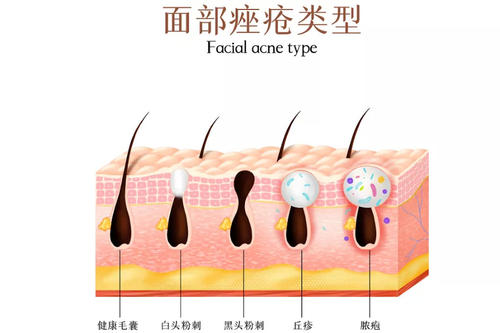 哈医大一院丁爽怎么样？医生简介\痤疮调节案例抢先看！