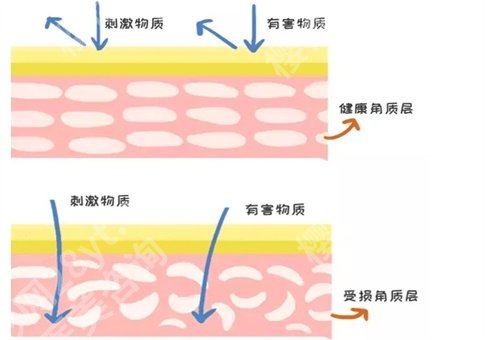 角质层薄用什么护肤品？是什么原因造成的？卸妆选择什么？一并整理了