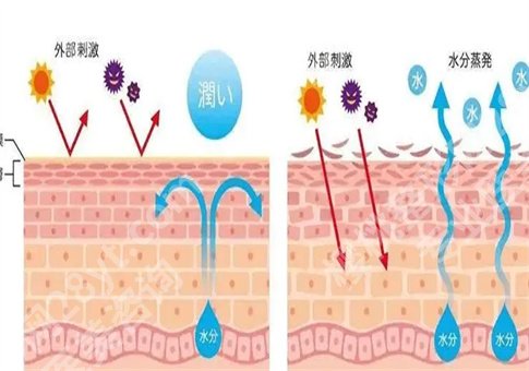 角质层薄用什么护肤品？是什么原因造成的？卸妆选择什么？一并整理了