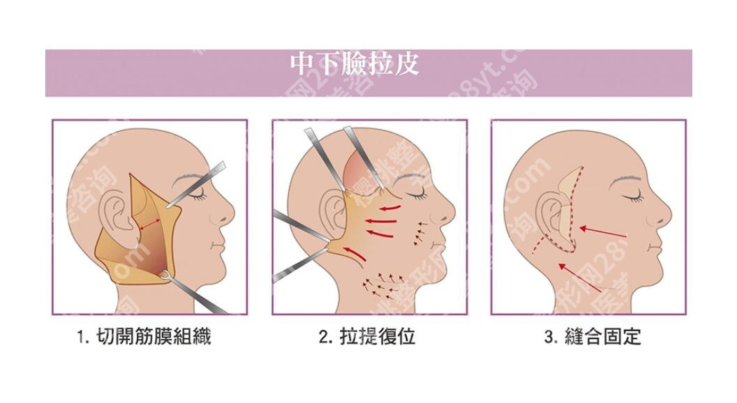 武汉协和医院拉皮除皱多少钱？价格费用明细、整形美容科简介