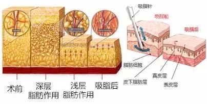 武汉协和医院脂肪填充怎么样？整形科简介、价格费用明细