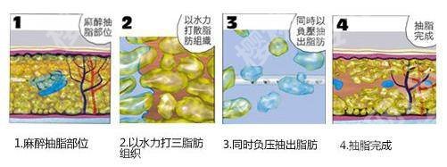 北京联合丽格陈万芳可靠吗？怎么样？医生简介、擅长项目公布！