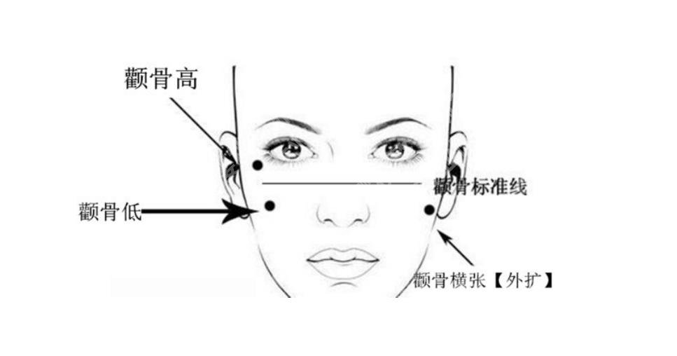 张笑天颧骨内推怎么样？医生口碑评价、个人资料公布！