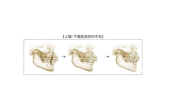 北京张笑天预约指南分享，内附个人简介、技术点评、手术价格