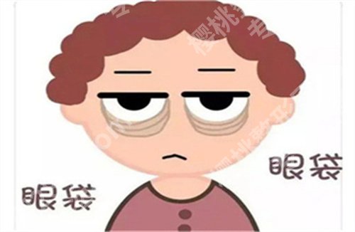 上海欧莱美整形医院去眼袋怎么样？祛眼袋案例在线看