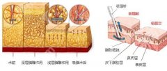 绵阳中心医院吸脂多少钱？腿部抽脂1.1w元起\腰部抽脂1.2w元起，附案例