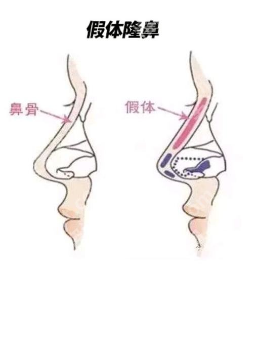 北京宫风勇怎么样？医生简介、隆鼻案例、坐诊医院介绍！