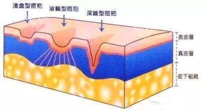 金竹红医生怎么样？坐诊医院、祛痘印案例、价格曝光！