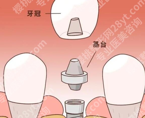 解放军总医院牙科怎么样？医院简介|专家名单|价格点评！