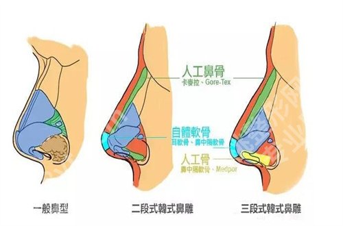 太原军大整形医院怎么样啊？医院的核心项目介绍