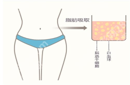 太原军大整形医院怎么样啊？医院的核心项目介绍