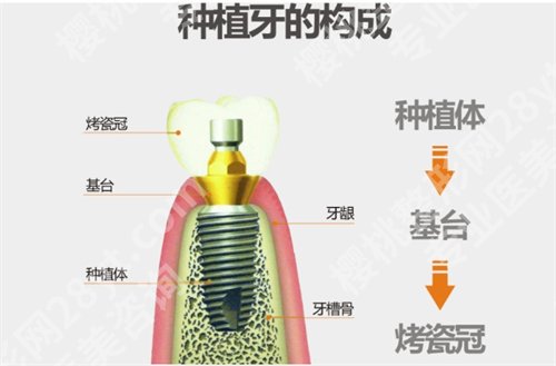 德贝口腔做种植牙好吗？医院基本信息介绍