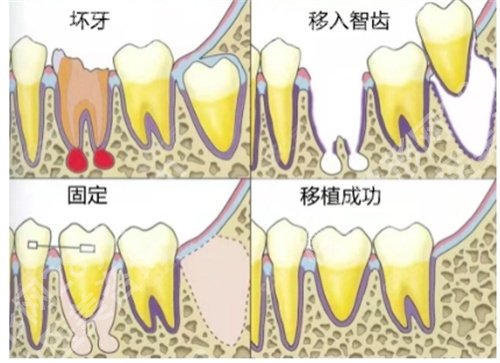 北京冠美口腔医院种植牙专家怎么样？价格表公布，特色项目介绍