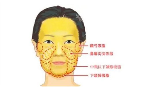 北京华韩高亚东医生如何？请收看详细的简介