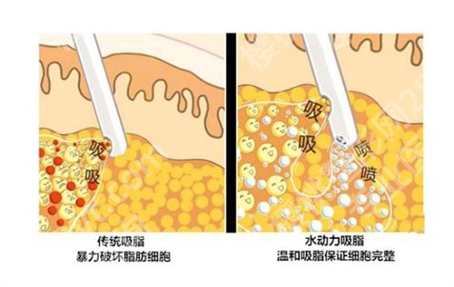 北京华韩高亚东医生如何？请收看详细的简介