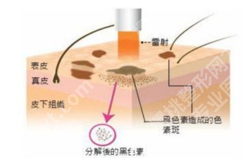 北京颐美激光美容怎么样？主打项目介绍，科普知识