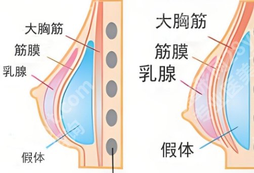 上海吕京陵医生做胸怎么样？医生特色项目介绍