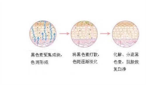 北京华韩医疗美容激光脱毛多少钱？一键查询价格明细