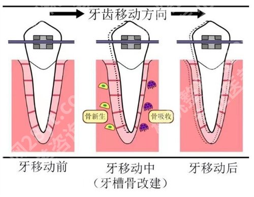 台州市立医院正畸科怎么样？相关案例介绍