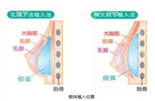 绍兴人民医院隆胸怎么样？医院亮点介绍