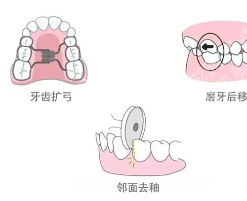 南京第二医院正颌手术费用是多少？一键了解收费价格