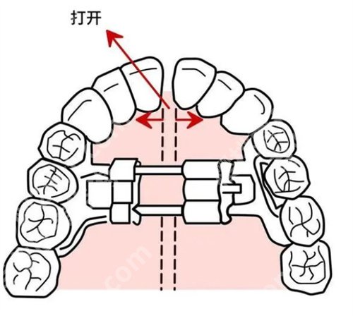 南京第二医院正颌手术费用是多少？一键了解收费价格