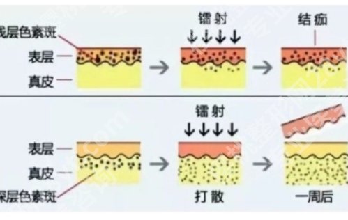 镇江第一医院祛斑怎么样？主打项目公布，科普知识问答