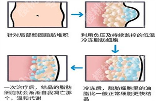 南京妇幼保健院吸脂多少钱？医院基本信息