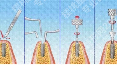 浙大口腔医院种植牙医生推荐，医院简介，一键查看详情