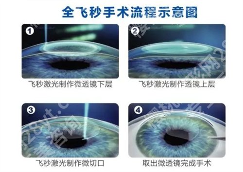 南京第二人民医院眼科专家都有谁看的好？主打项目来袭