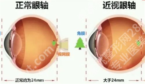 南京第二人民医院眼科专家都有谁看的好？主打项目来袭