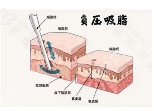 苏北医院假体隆胸怎么样？一览院内简介内容