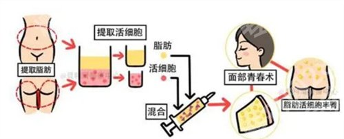 徐州第一人民医院去疤痕怎么样？看医院特色项目介绍