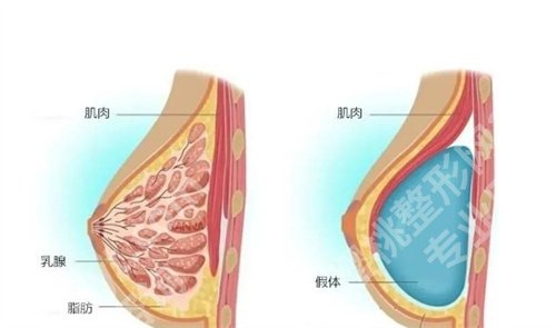 徐州中心医院假体隆胸怎么样？专业团队介绍