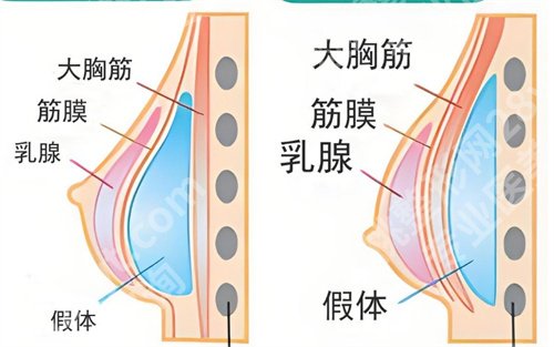 徐州中心医院假体隆胸怎么样？专业团队介绍