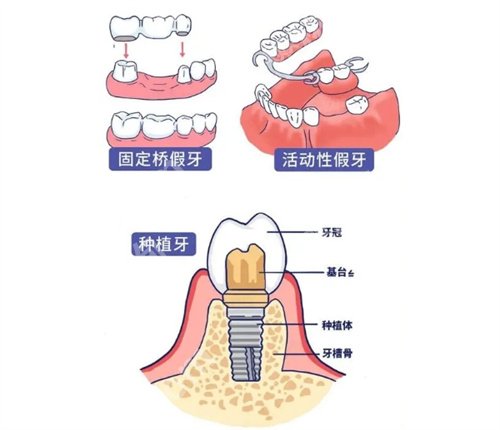 徐州中心医院牙齿矫正多少钱？看全新价格表公布