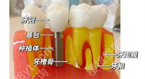 徐州中心医院牙科收费标准吗？看医院技术亮点